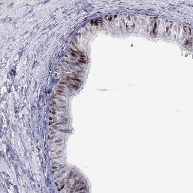 DBF4B Antibody Immunohistochemistry-Paraffin: DBF4B Antibody [NBP3-24777]