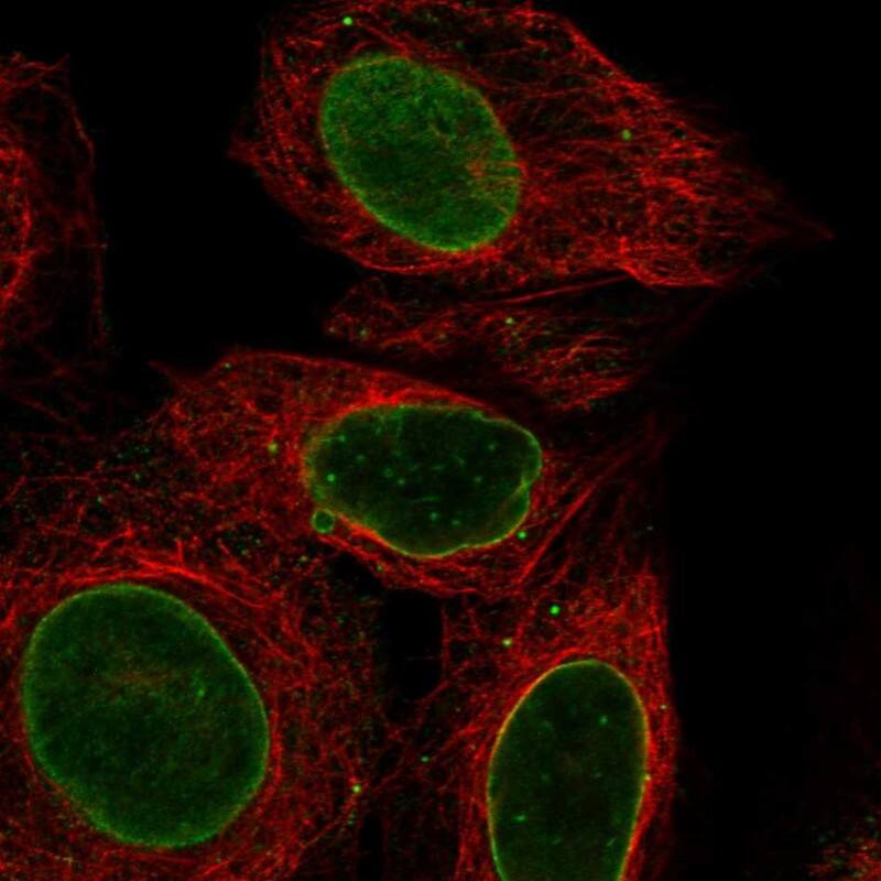 DBX2 Antibody Immunocytochemistry/Immunofluorescence: DBX2 Antibody [NBP3-24778]