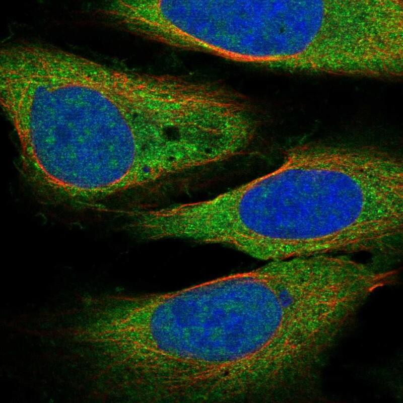 DCLK3 Antibody Immunocytochemistry/Immunofluorescence: DCLK3 Antibody [NBP3-24779]