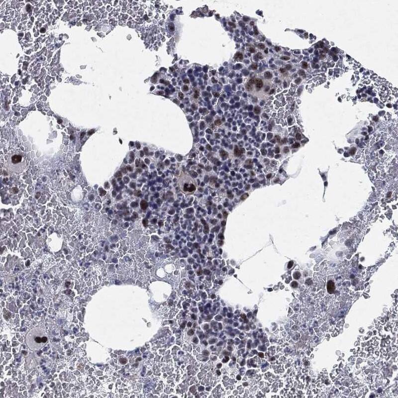 DDX27 Antibody Immunohistochemistry-Paraffin: DDX27 Antibody [NBP3-24781]