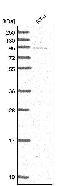 DDX27 Antibody Western Blot: DDX27 Antibody [NBP3-24781]