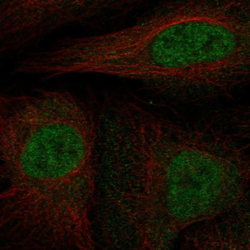 p15INK4b/CDKN2B Antibody Immunocytochemistry/Immunofluorescence: p15INK4b/CDKN2B Antibody [NBP3-24782]