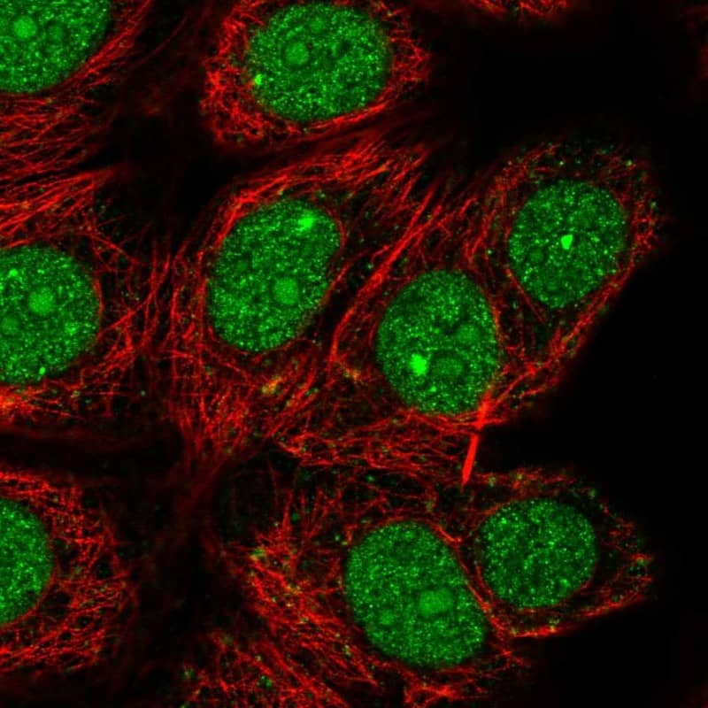 DEDD Antibody Immunocytochemistry/Immunofluorescence: DEDD Antibody [NBP3-24783]