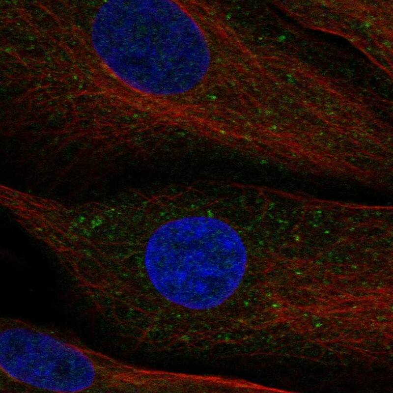 DIP13B Antibody Immunocytochemistry/Immunofluorescence: DIP13B Antibody [NBP3-24788]