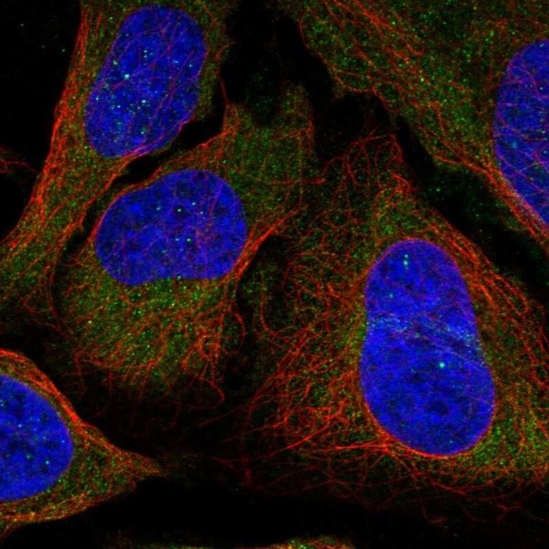 DLC1 Antibody Immunocytochemistry/Immunofluorescence: DLC1 Antibody [NBP3-24789]