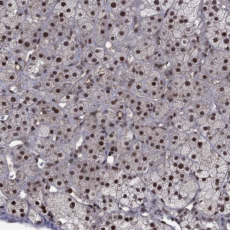 DMAP1 Antibody Immunohistochemistry-Paraffin: DMAP1 Antibody [NBP3-24791]