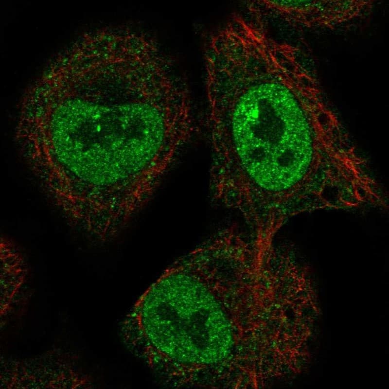 DNA helicase B Antibody Immunocytochemistry/Immunofluorescence: DNA helicase B Antibody [NBP3-24792]