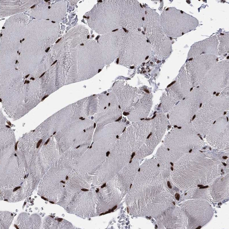 DNA Polymerase beta Antibody Immunohistochemistry-Paraffin: DNA Polymerase beta Antibody [NBP3-24793]