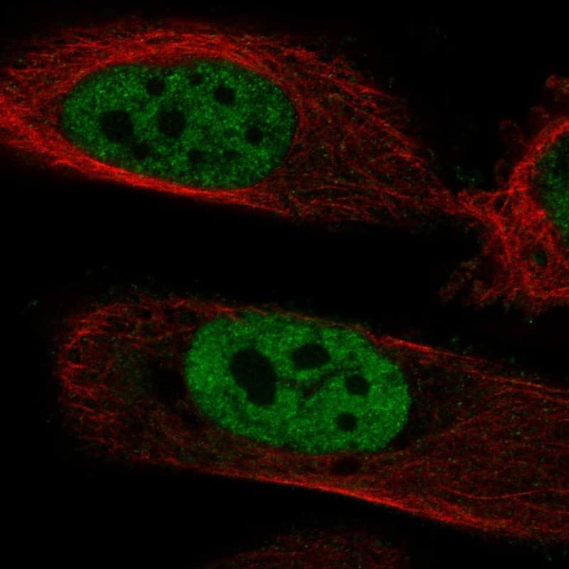 DNA polymerase mu Antibody Immunocytochemistry/Immunofluorescence: DNA polymerase mu Antibody [NBP3-24794]