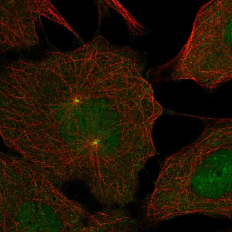 DNAJC28 Antibody Immunocytochemistry/Immunofluorescence: DNAJC28 Antibody [NBP3-24795]