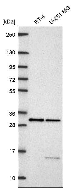 PRPK Antibody Western Blot: PRPK Antibody [NBP3-24799]