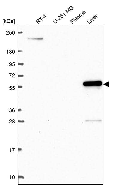 DPYS Antibody Western Blot: DPYS Antibody [NBP3-24800]