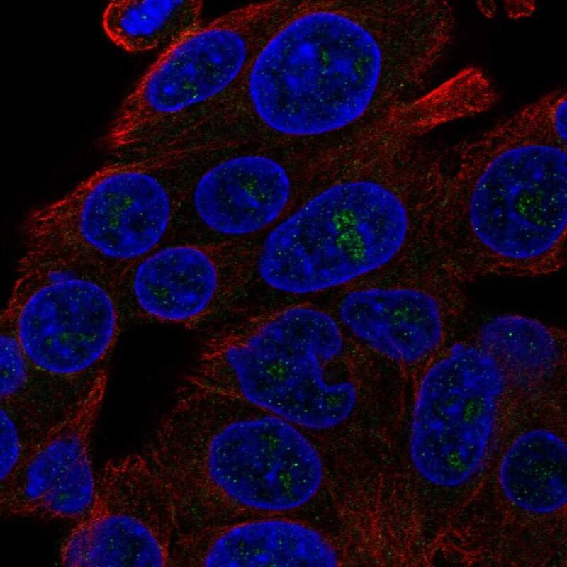 DQX1 Antibody Immunocytochemistry/Immunofluorescence: DQX1 Antibody [NBP3-24801]