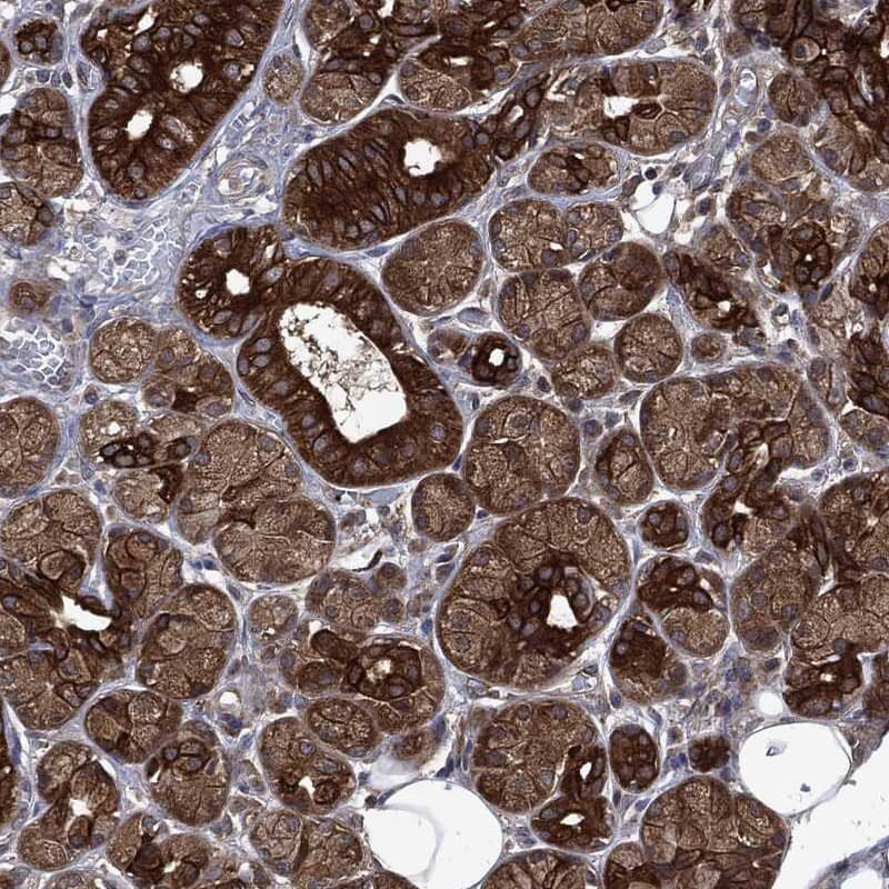 Dynactin Subunit 1/DCTN1 Antibody Immunohistochemistry-Paraffin: Dynactin Subunit 1/DCTN1 Antibody [NBP3-24804]