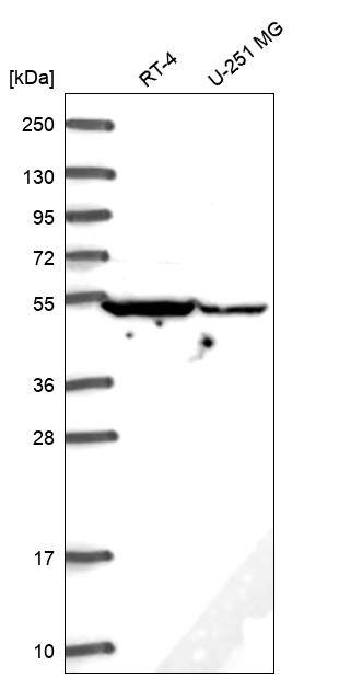 DYNC1LI2 Antibody Western Blot: DYNC1LI2 Antibody [NBP3-24805]