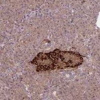 DYNC1LI2 Antibody Immunohistochemistry-Paraffin: DYNC1LI2 Antibody [NBP3-24805]