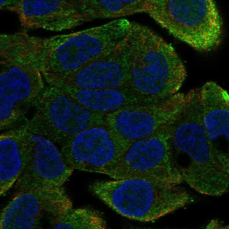 DYX1C1 Antibody Immunocytochemistry/Immunofluorescence: DYX1C1 Antibody [NBP3-24806]