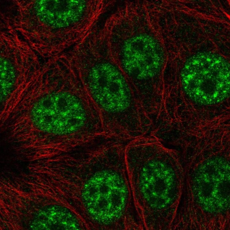 EAPP Antibody Immunocytochemistry/Immunofluorescence: EAPP Antibody [NBP3-24807]