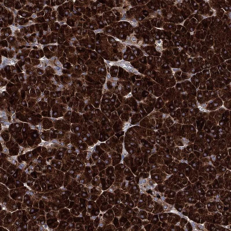 EIF2 beta Antibody Immunohistochemistry-Paraffin: EIF2 beta Antibody [NBP3-24812]