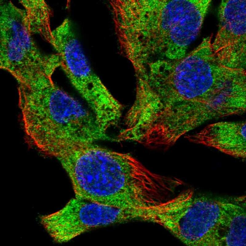 eIF2B4 Antibody Immunocytochemistry/Immunofluorescence: eIF2B4 Antibody [NBP3-24813]