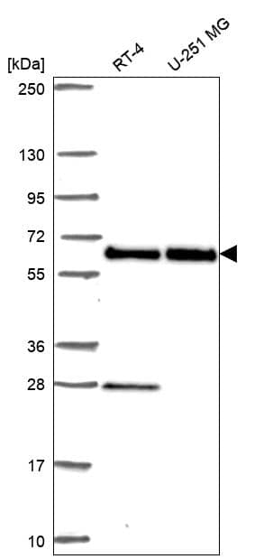 eIF2B4 Antibody Western Blot: eIF2B4 Antibody [NBP3-24813]