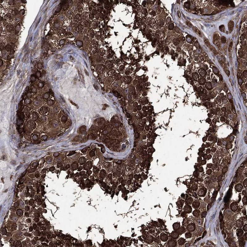 eIF2B4 Antibody Immunohistochemistry-Paraffin: eIF2B4 Antibody [NBP3-24813]