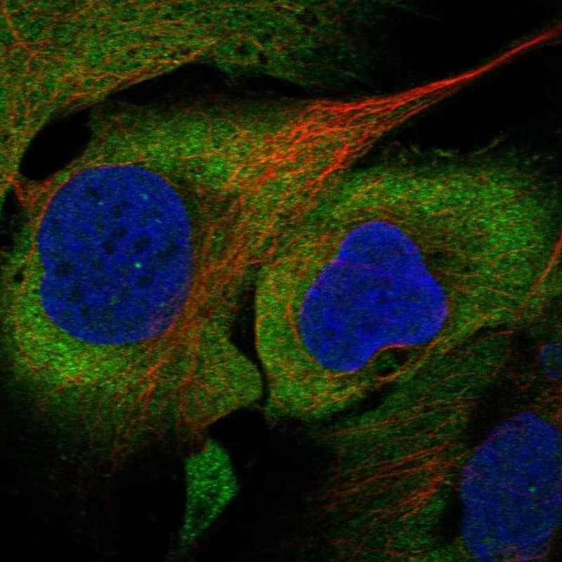 eIF5A Antibody Immunocytochemistry/Immunofluorescence: eIF5A Antibody [NBP3-24814]