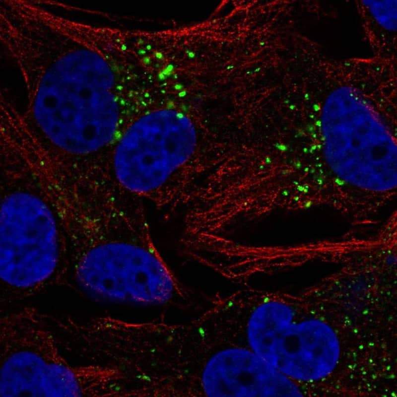 EMP1 Antibody Immunocytochemistry/Immunofluorescence: EMP1 Antibody [NBP3-24816]