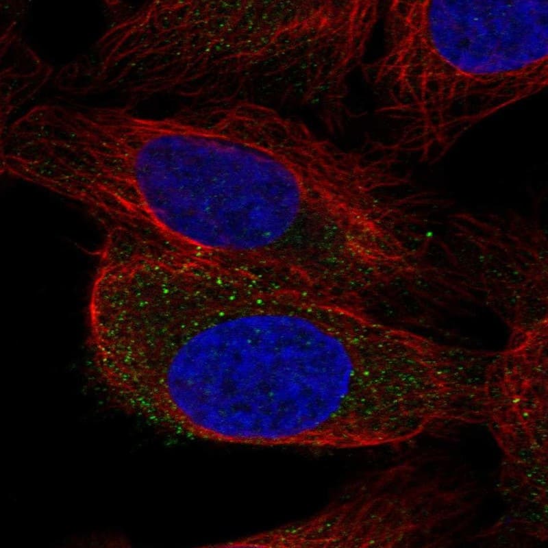 ENTHD2 Antibody Immunocytochemistry/Immunofluorescence: ENTHD2 Antibody [NBP3-24817]