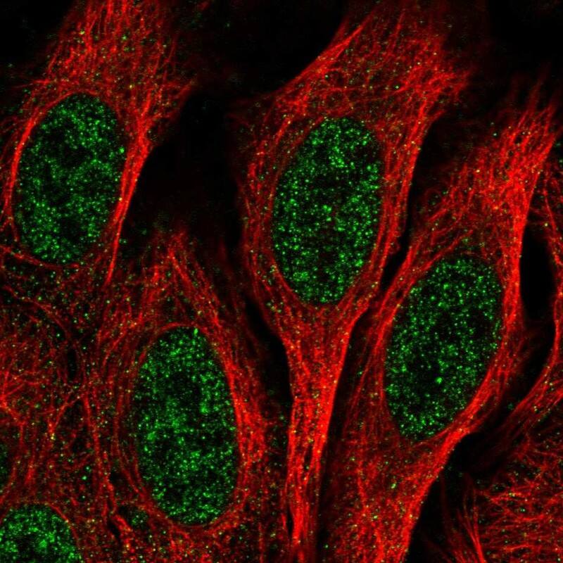 EPC1 Antibody Immunocytochemistry/Immunofluorescence: EPC1 Antibody [NBP3-24818]