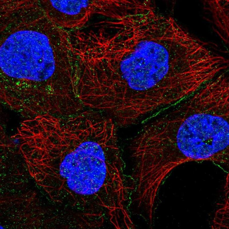 Eps8 Antibody Immunocytochemistry/Immunofluorescence: Eps8 Antibody [NBP3-24819]