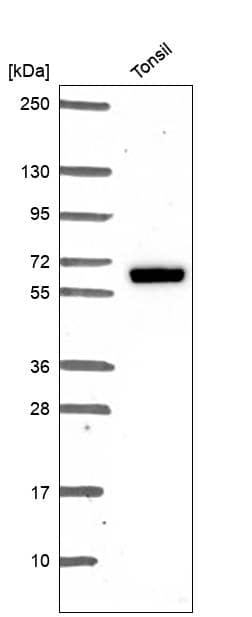 ER beta/NR3A2 Antibody Western Blot: ER beta/NR3A2 Antibody [NBP3-24821]