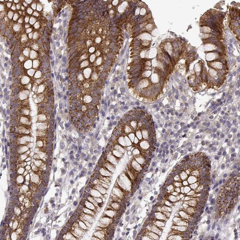 ErbB3/Her3 Antibody Immunohistochemistry-Paraffin: ErbB3/Her3 Antibody [NBP3-24822]