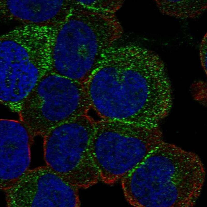 ESAM Antibody Immunocytochemistry/Immunofluorescence: ESAM Antibody [NBP3-24823]