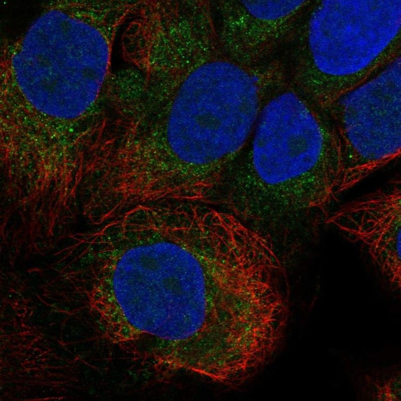 EY Cadherin Antibody Immunocytochemistry/Immunofluorescence: EY Cadherin Antibody [NBP3-24825]