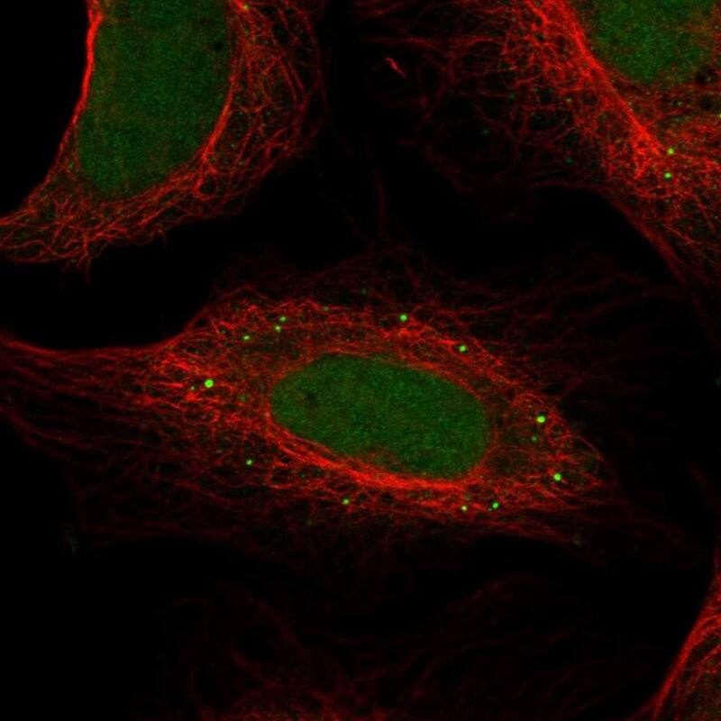 FAM186A Antibody Immunocytochemistry/Immunofluorescence: FAM186A Antibody [NBP3-24829]