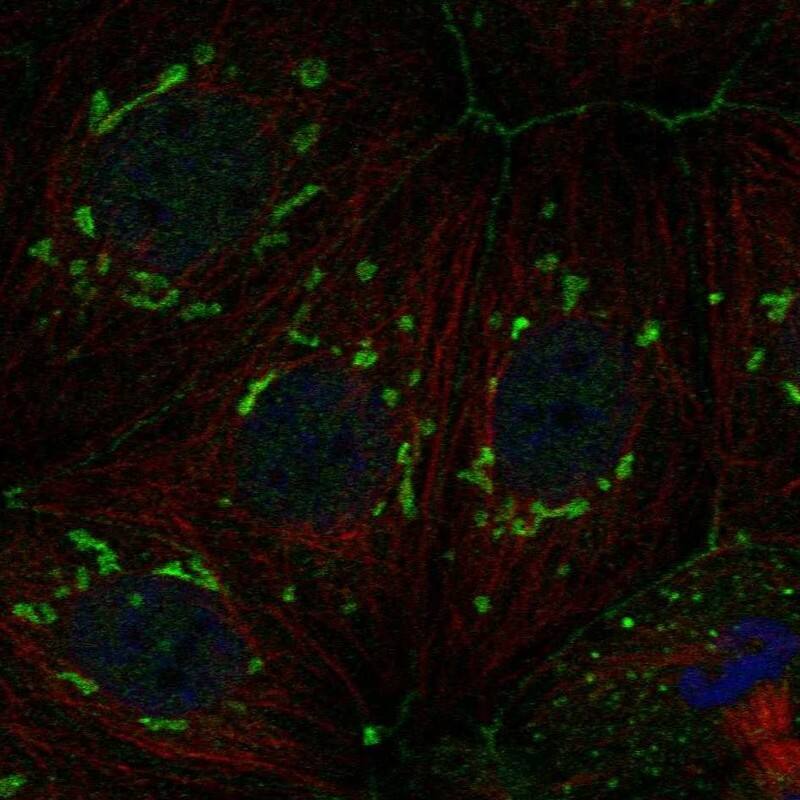 FAM222A Antibody Immunocytochemistry/Immunofluorescence: FAM222A Antibody [NBP3-24832]