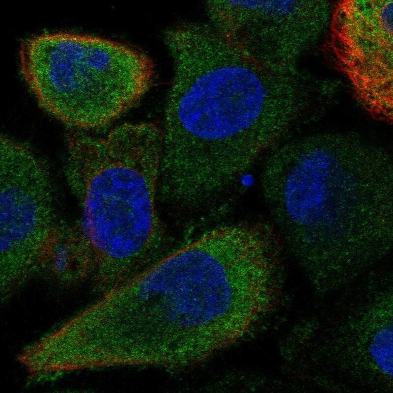 FAM83E Antibody Immunocytochemistry/Immunofluorescence: FAM83E Antibody [NBP3-24837]