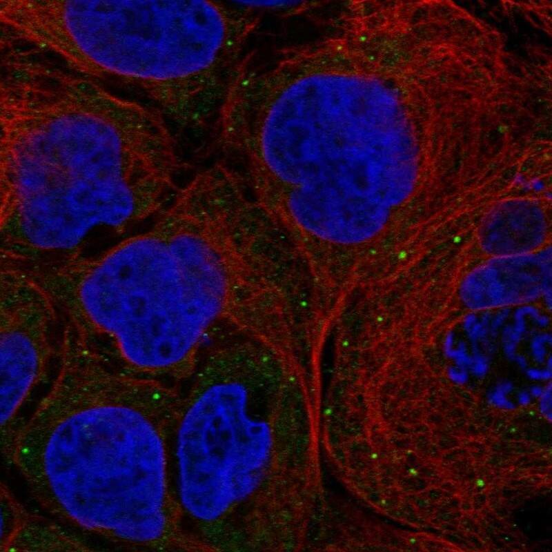 FANCD2OS Antibody Immunocytochemistry/Immunofluorescence: FANCD2OS Antibody [NBP3-24838]