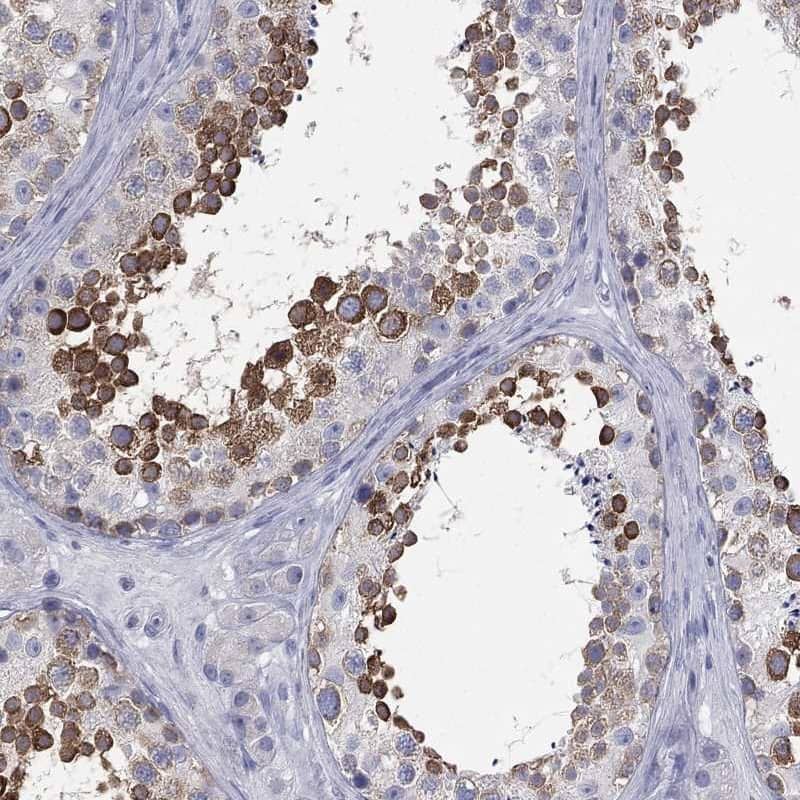 STK31 Antibody Immunohistochemistry-Paraffin: STK31 Antibody [NBP3-24839]