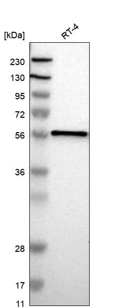 FANCE Antibody Western Blot: FANCE Antibody [NBP3-24840]