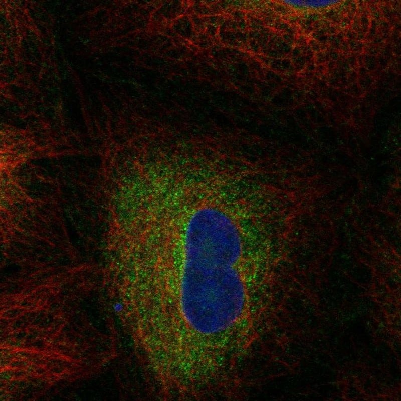 Fatty acid desaturase 2 Antibody Immunocytochemistry/Immunofluorescence: Fatty acid desaturase 2 Antibody [NBP3-24842]