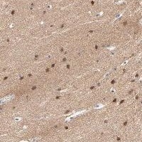 FBXL5 Antibody Immunohistochemistry-Paraffin: FBXL5 Antibody [NBP3-24843]