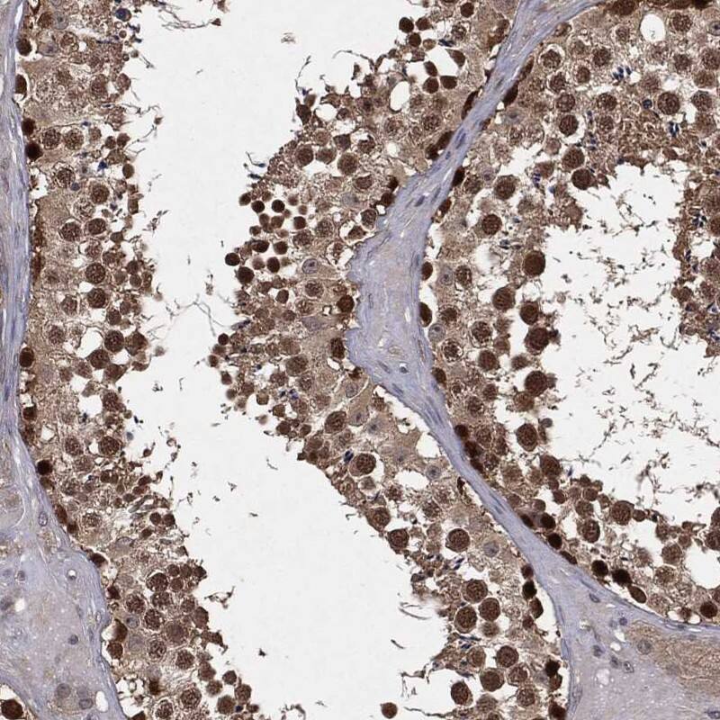 FBXO7 Antibody Immunohistochemistry-Paraffin: FBXO7 Antibody [NBP3-24844]