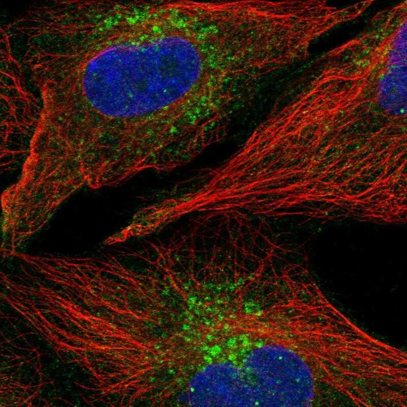 FENS1 Antibody Immunocytochemistry/Immunofluorescence: FENS1 Antibody [NBP3-24845]