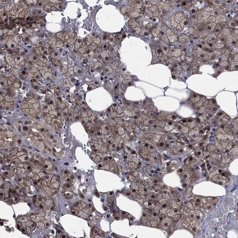 FGD1 Antibody Immunohistochemistry-Paraffin: FGD1 Antibody [NBP3-24847]