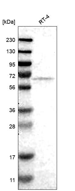 FKBP10 Antibody Western Blot: FKBP10 Antibody [NBP3-24849]