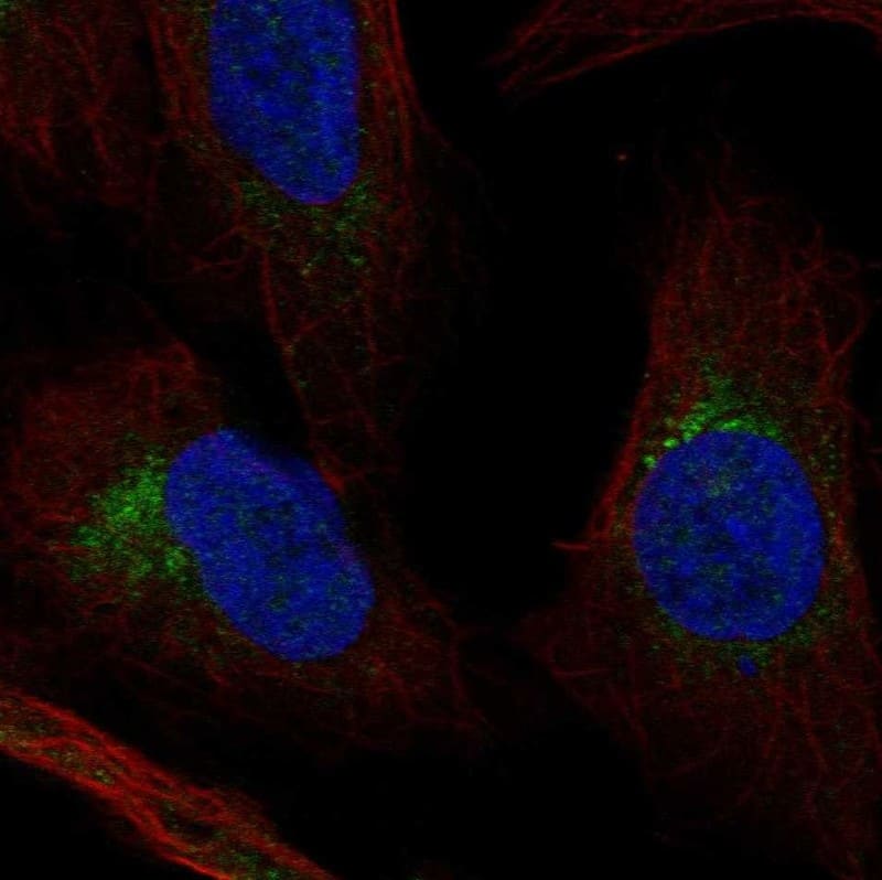 FKBP10 Antibody Immunocytochemistry/Immunofluorescence: FKBP10 Antibody [NBP3-24849]