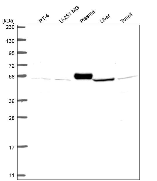FLJ10815 Antibody Western Blot: FLJ10815 Antibody [NBP3-24851]