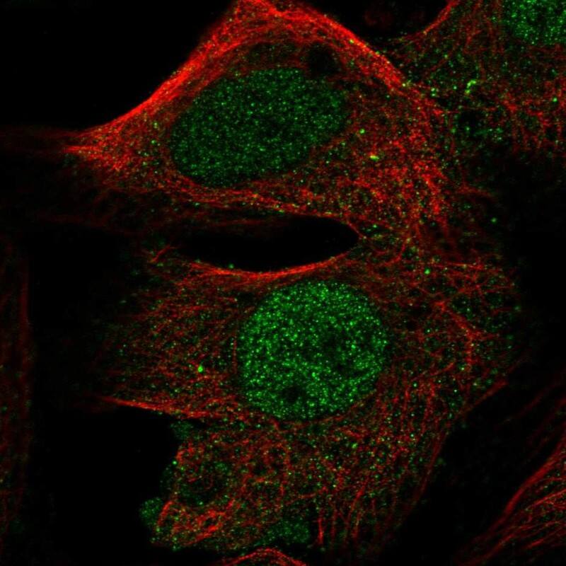 FOXD4L1 Antibody Immunocytochemistry/Immunofluorescence: FOXD4L1 Antibody [NBP3-24853]